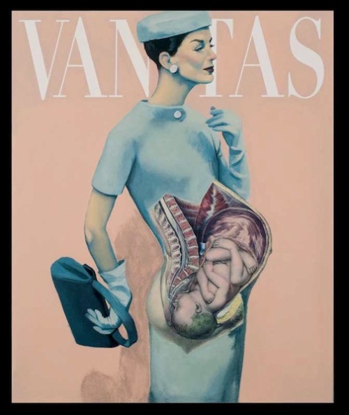 Vanitas Fernando Vicente 21 Femme Fetal